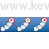 Picture 2/2 -Akkor választjuk ki jól a matrica hosszát, ha a 2 véghüvely pont a következő approximális térbe szorul be!