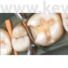 Picture 5/13 -Metal subdivided sticker, 50 pieces/box, molar , thickness: 0.038 mm - in various designs
