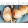 Picture 6/13 -Metal subdivided sticker, 50 pieces/box, molar , thickness: 0.038 mm - in various designs