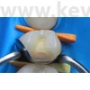 Picture 2/13 -Metal subdivided sticker, 50 pieces/box, molar , thickness: 0.038 mm - in various designs
