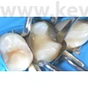 Picture 8/13 -Metal subdivided sticker, 50 pieces/box, molar , thickness: 0.038 mm - in various designs