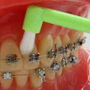 Fogszabályzós fogkefe, 1db