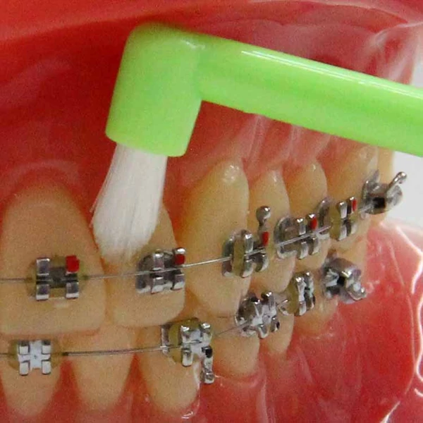 Fogszabályzós fogkefe, 1db